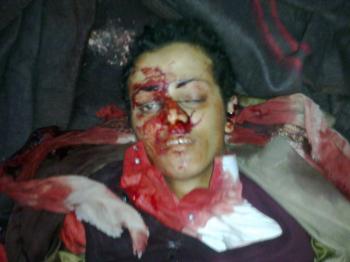 شاهد عيان يروي احداث مجزرة الأمس بعد صلاة الجمعة 